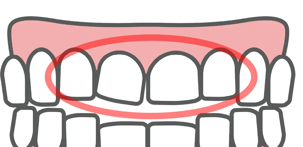 歯の形や色が気になる｜東京都港区