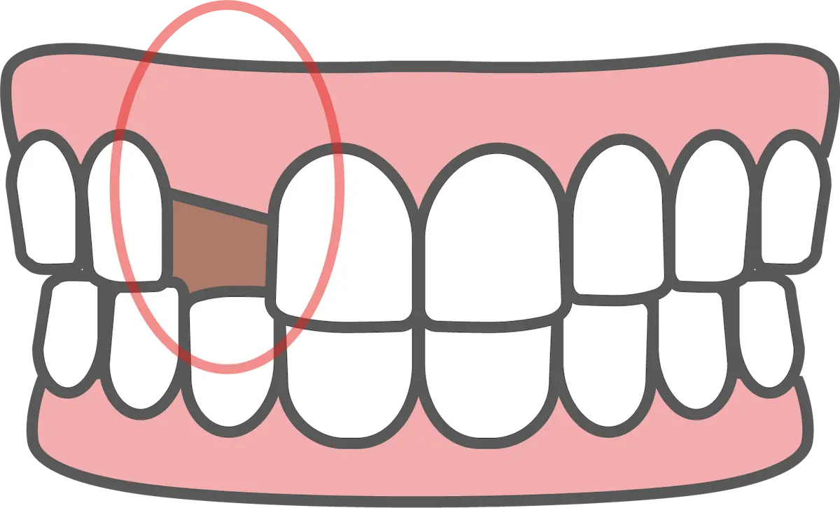 インプラント｜東京都港区青山