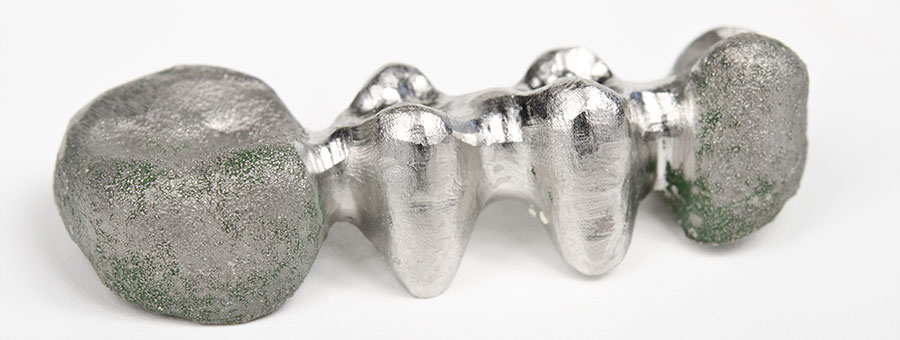 東京都港区青山の歯医者 銀合金