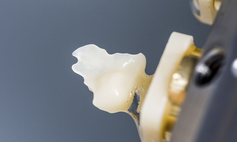 東京都港区青山の歯医者 ハイブリッドセラミックス