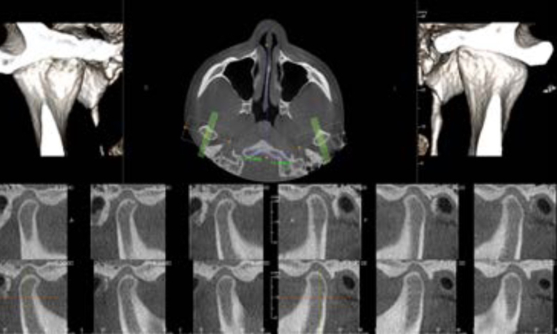 東京都港区青山の歯医者 画質の向上はもちろん、よりエックス線を抑えた撮影が実現。