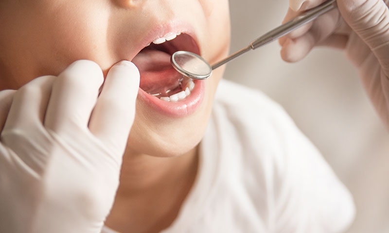 東京都港区青山の歯医者 小児歯科について