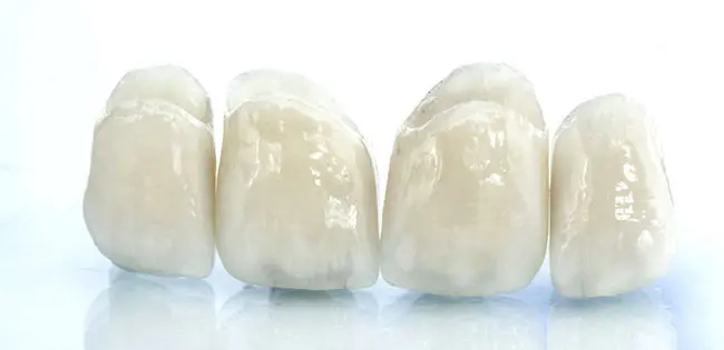 港区青山にある青山一丁目の歯医者　オールセラミック